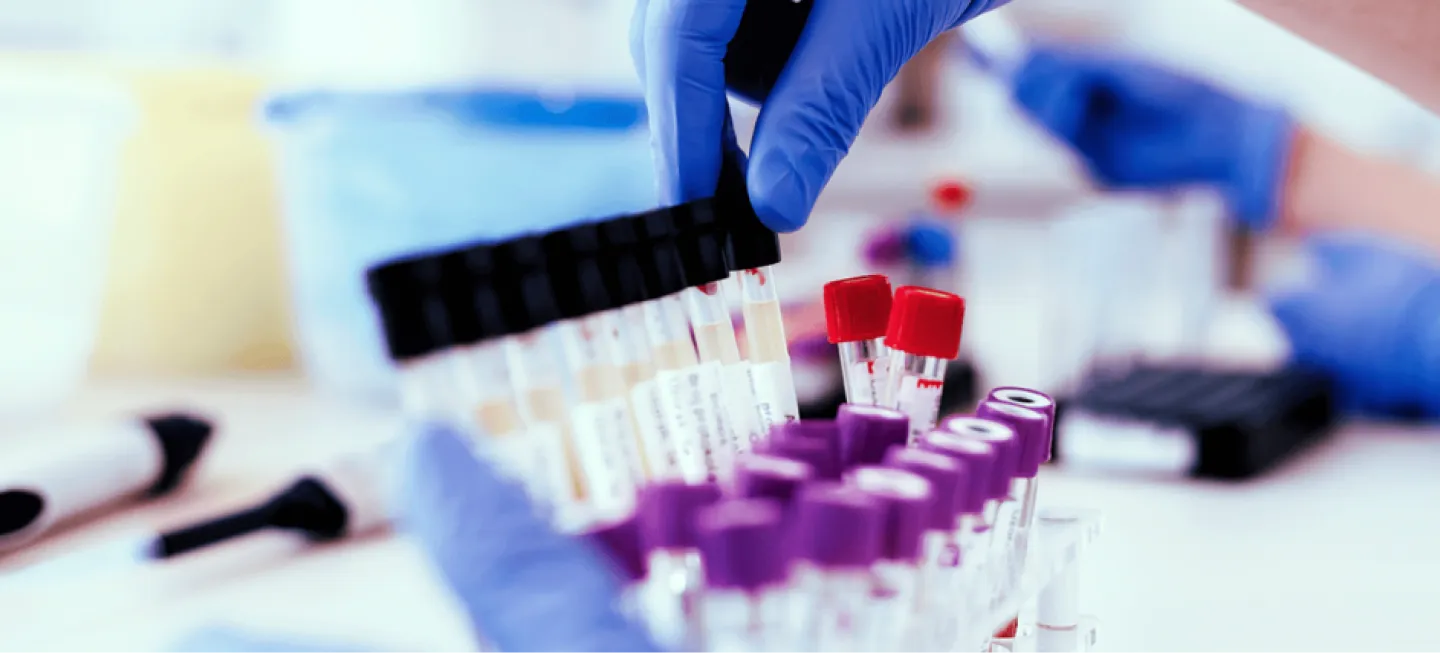 Procedure Coding: When to Use the 91 Modifier