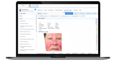 Smart-Charting-and-Dermatology-Billing